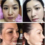 Magični Serum Protiv Starenja