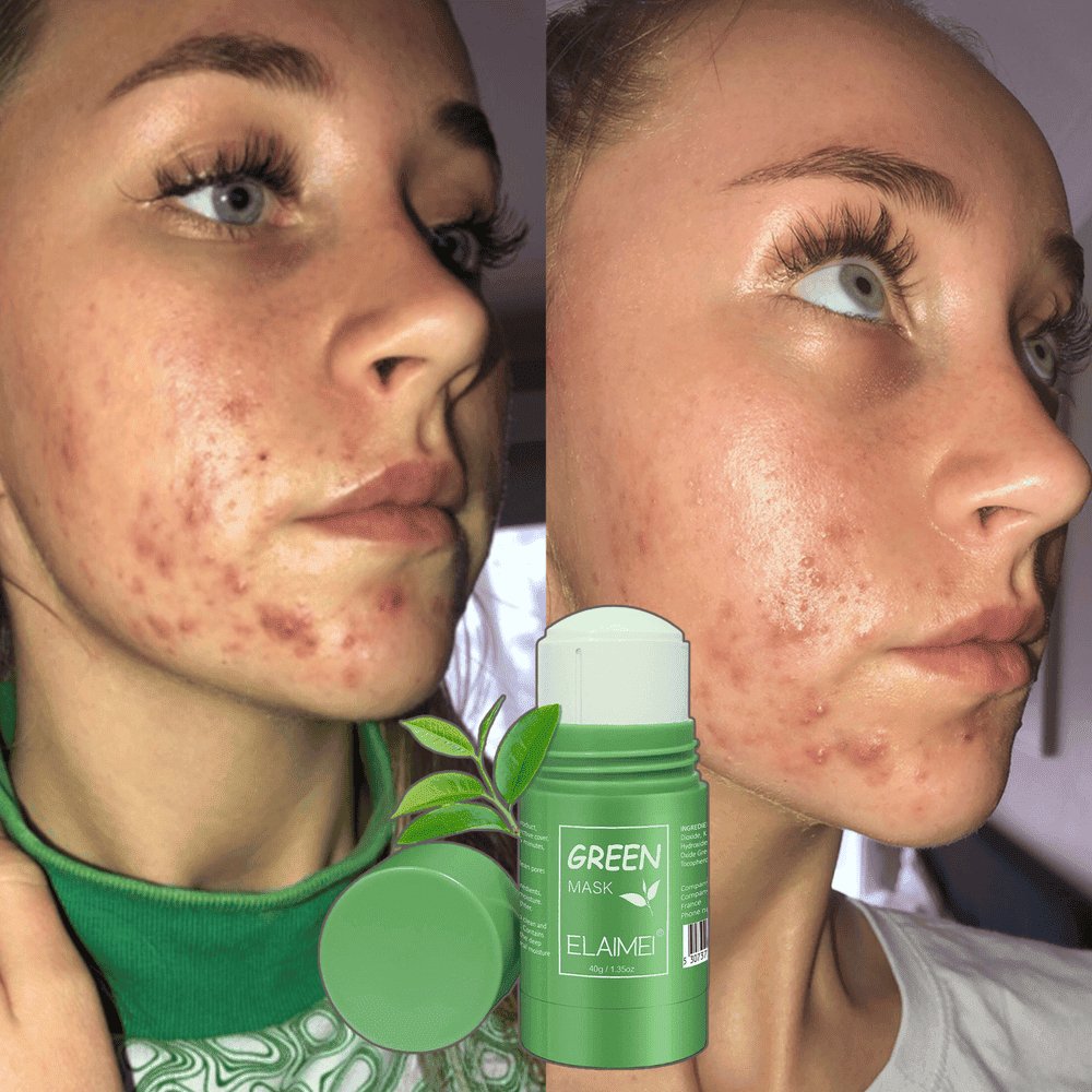 UNIŠTAVAČ Mitiserima na LICU - Zelena maska za MITISERE + Misteriozni poklon!