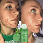 UNIŠTAVAČ Mitiserima na LICU - Zelena maska za MITISERE + Misteriozni poklon!